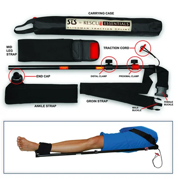 STS Slishman Traksiyon Splint