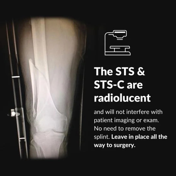 STS Slishman Traksiyon Splint